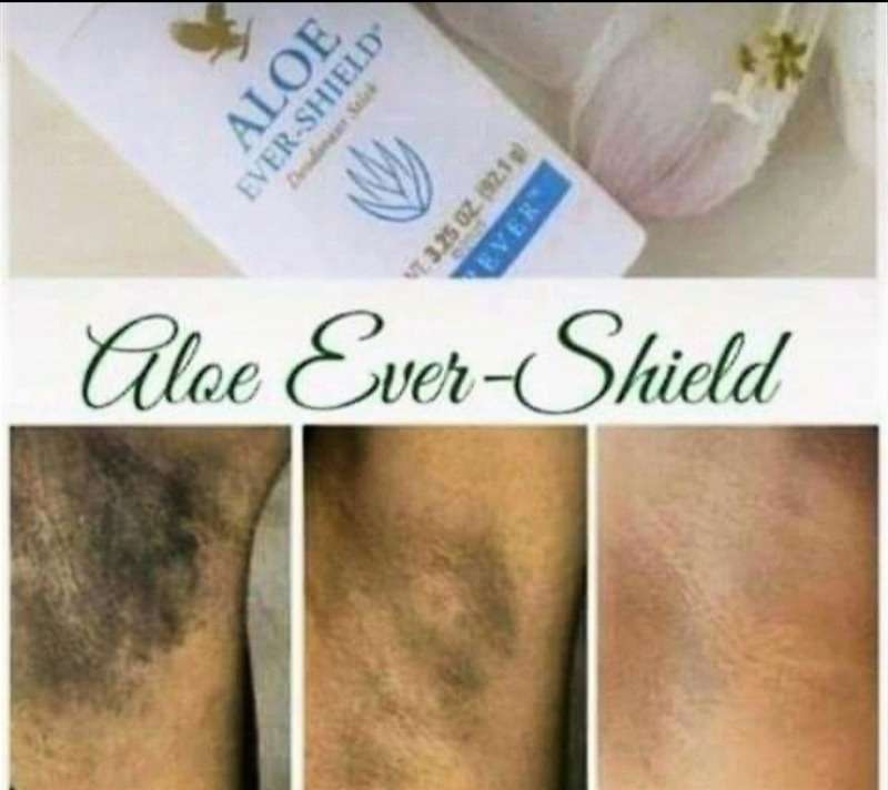 Aloe Ever-shield