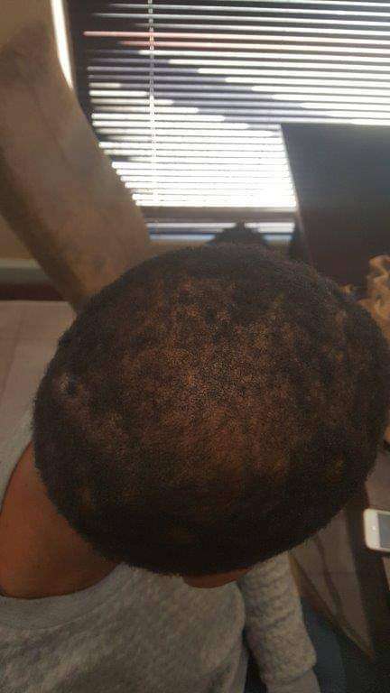 Ultimate Hair Regrowth Program